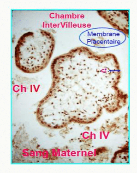 Chambre inter-villeuse et membrane placentaire (histologie)