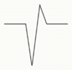 Complexe QRS diphasique enregistré dans une dérivation perpendiculaire au vecteur cardiaque.