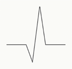 Complexe QRS négatif enregistré dans une dérivation dont l'axe est opposé au vecteur cardiaque.