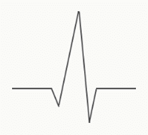 Complexe QRS positif enregistré dans une dérivation dont l'axe est aligné avec le vecteur cardiaque.