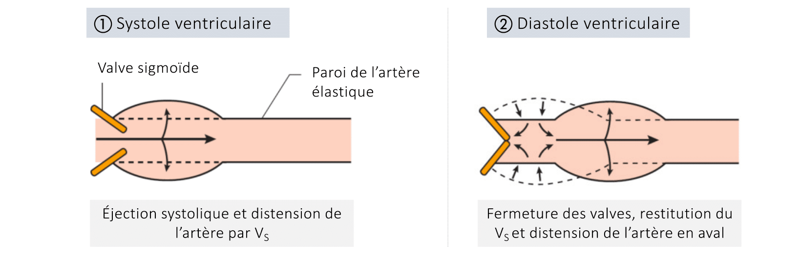 Schéma illustrant la compliance vasculaire avec une valve sigmoïde et une paroi élastique déformable sous l'effet de la pression intraluminale.