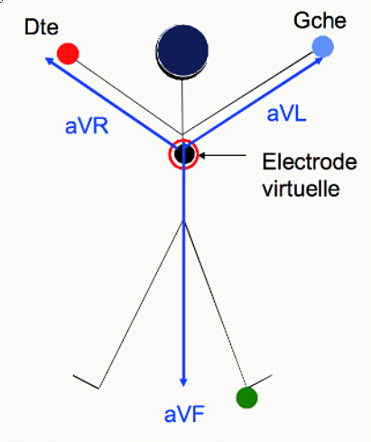 Dérivations unipolaires augmentées aVR, aVL, aVF et électrode virtuelle de Goldberger.