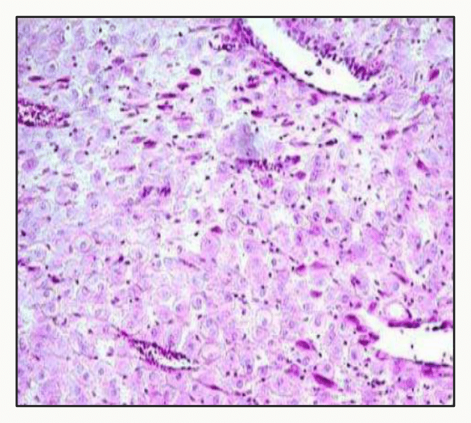 Coupe histologique du placenta colorée à l'hématoxyline-éosine montrant les villosités choriales