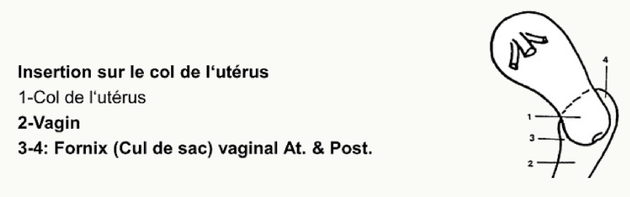 Insertion du col de l'utérus sur le vagin et fornix antérieur, postérieur et latéraux