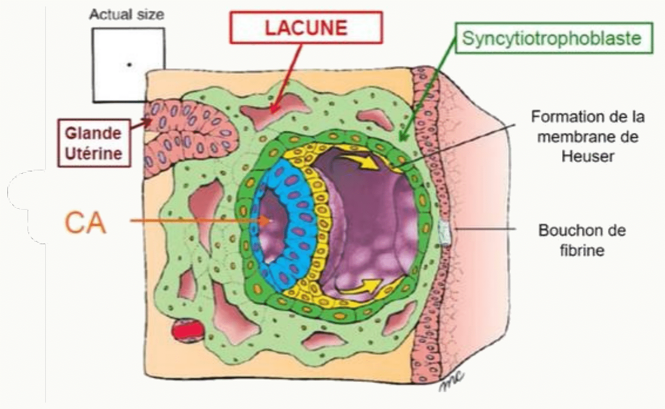 Stade lacunaire : lacunes du syncytiotrophoblaste remplies de sang maternel, membrane de Heuser, bouchon de fibrine et mésoderme extra-embryonnaire