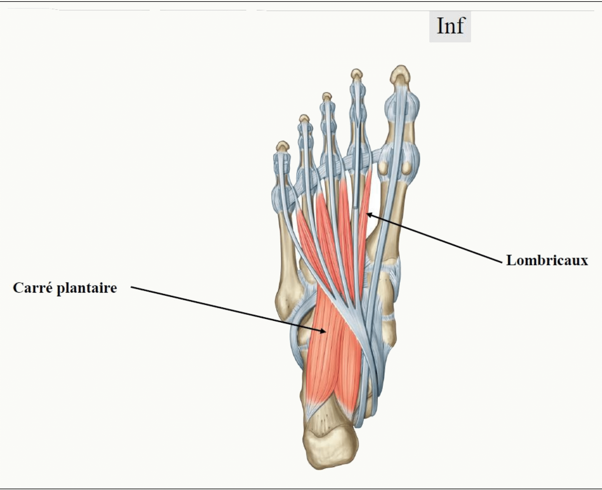 Plan plantaire intermédiaire : carré plantaire et muscles lombricaux, avec les tendons fléchisseurs