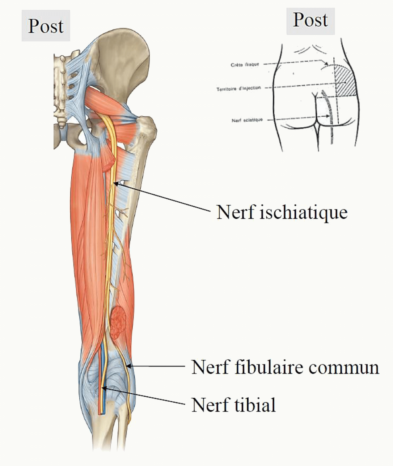 Nerf sciatique à la face postérieure de la cuisse et sa division en nerfs tibial et fibulaire commun