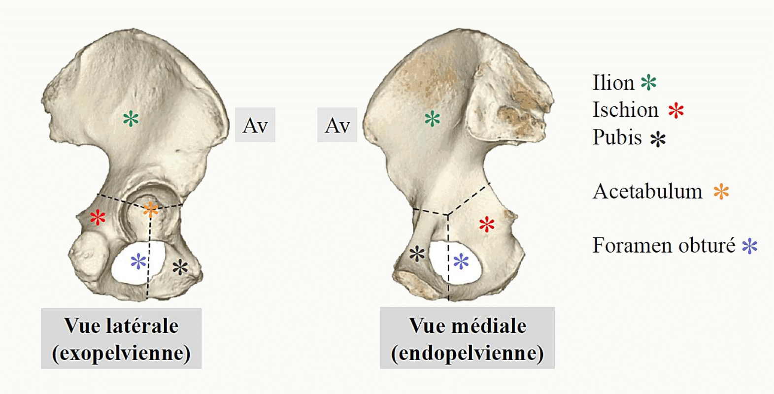 Os coxal en vue latérale et médiale : ilion, ischion, pubis, acétabulum et foramen obturé
