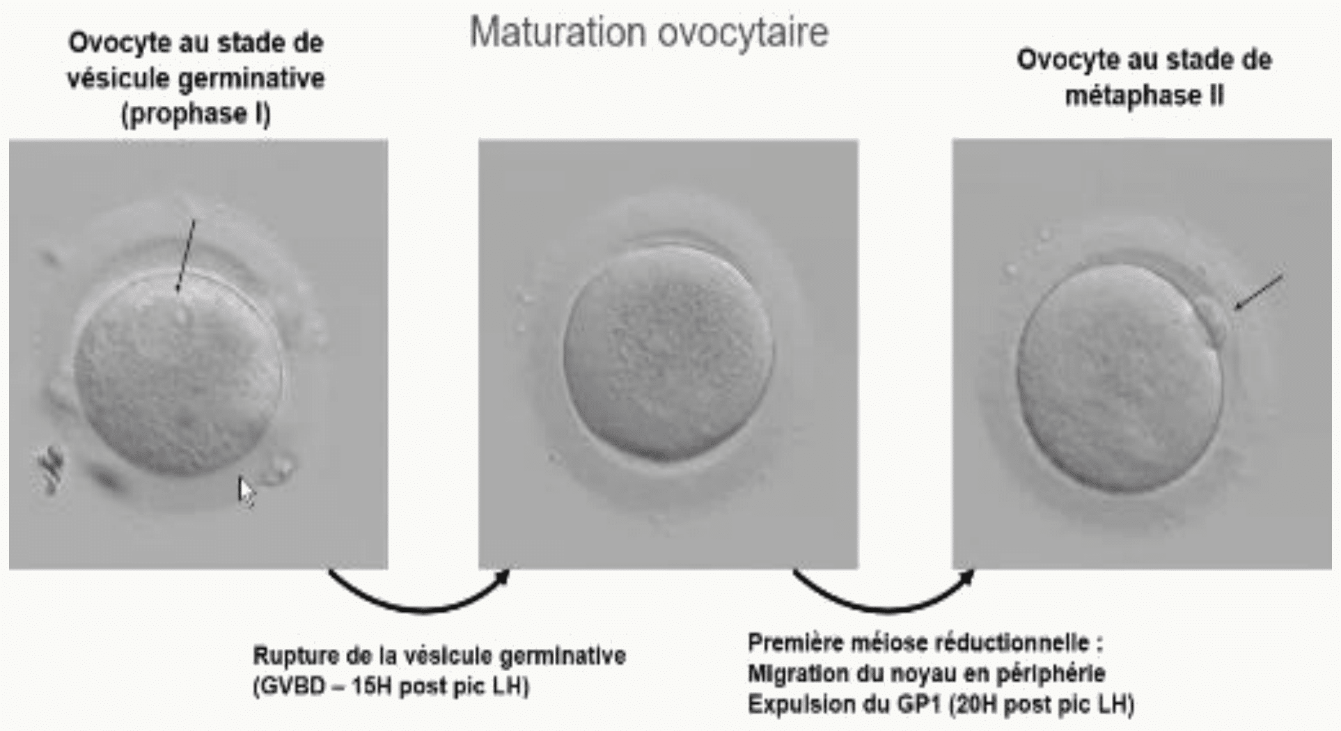 Ovocyte : vésicule germinative et étapes de la maturation nucléaire