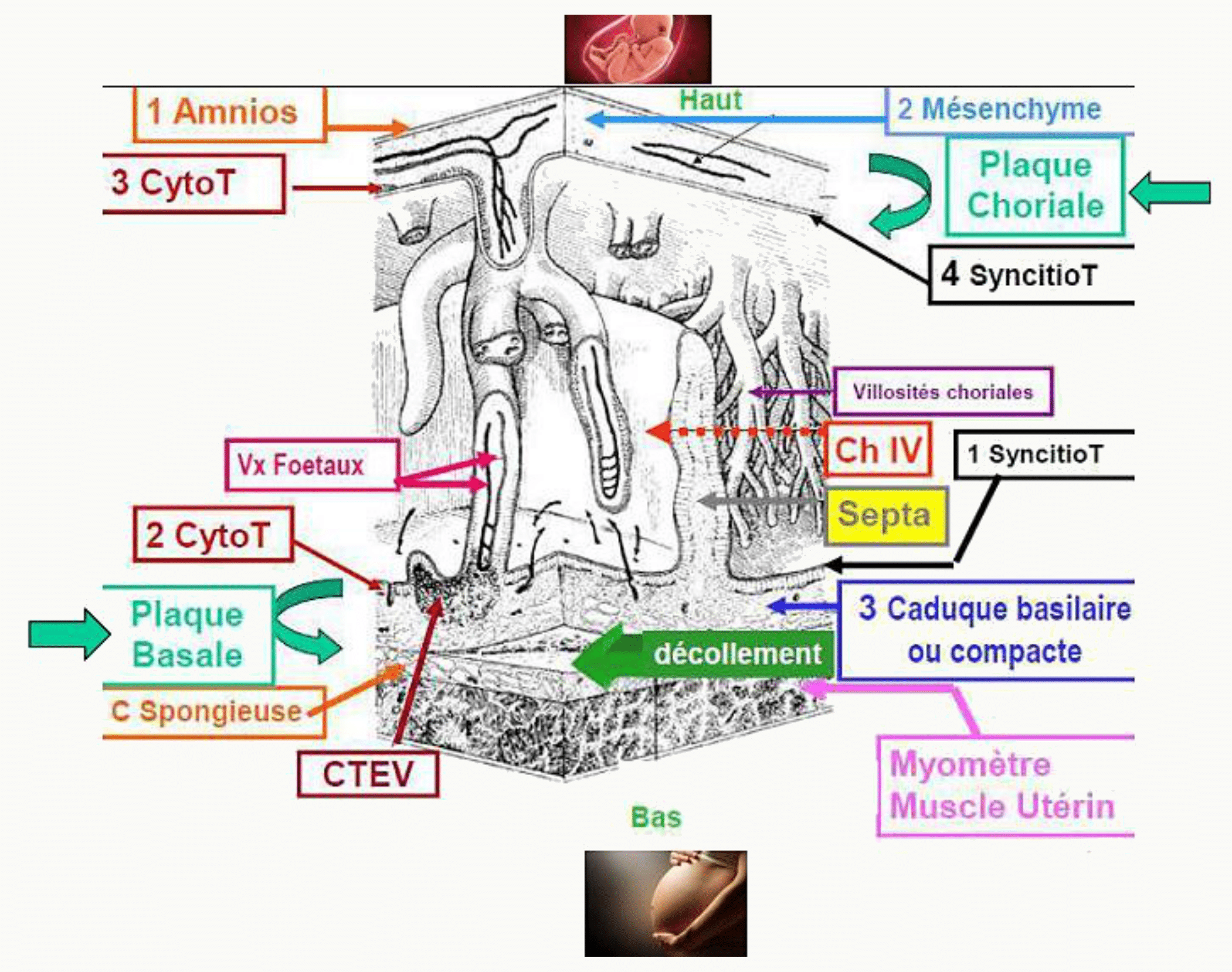 Le placenta à terme : plaques choriale et basale, villosités et septa en dissection
