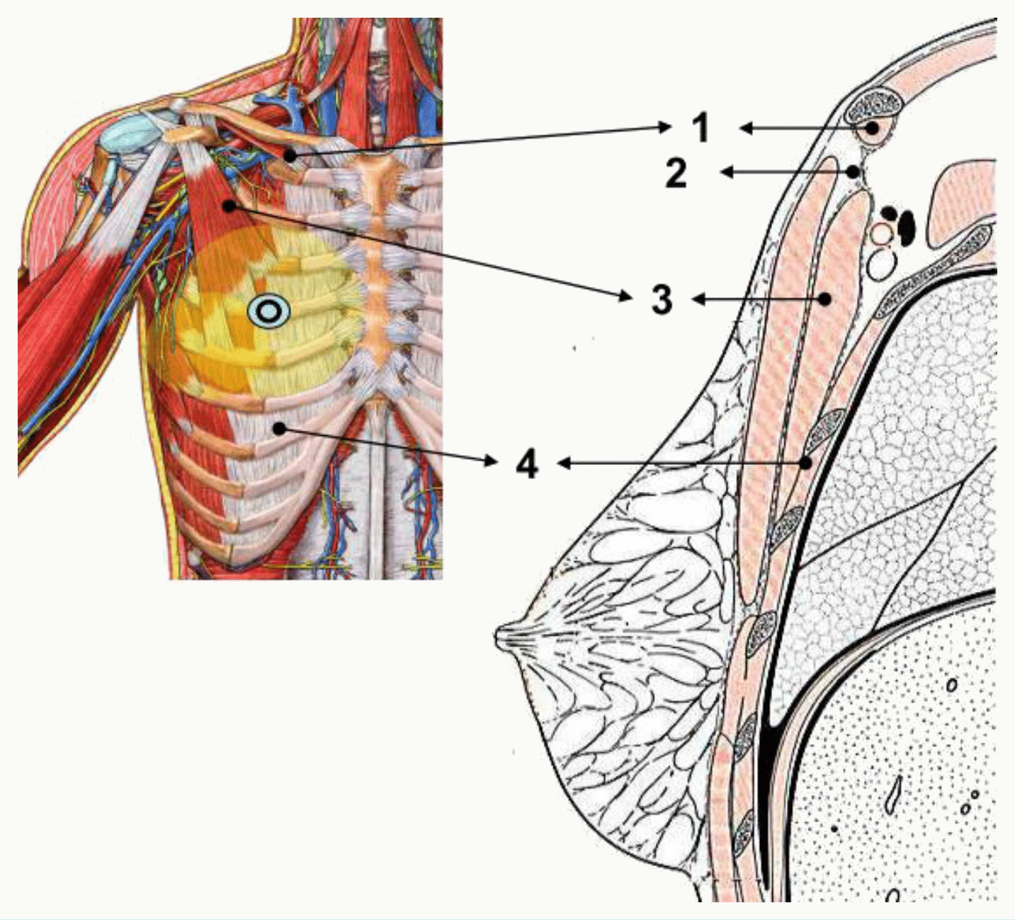 Plans de glissement rétro-mammaires entre la glande et le fascia du grand pectoral