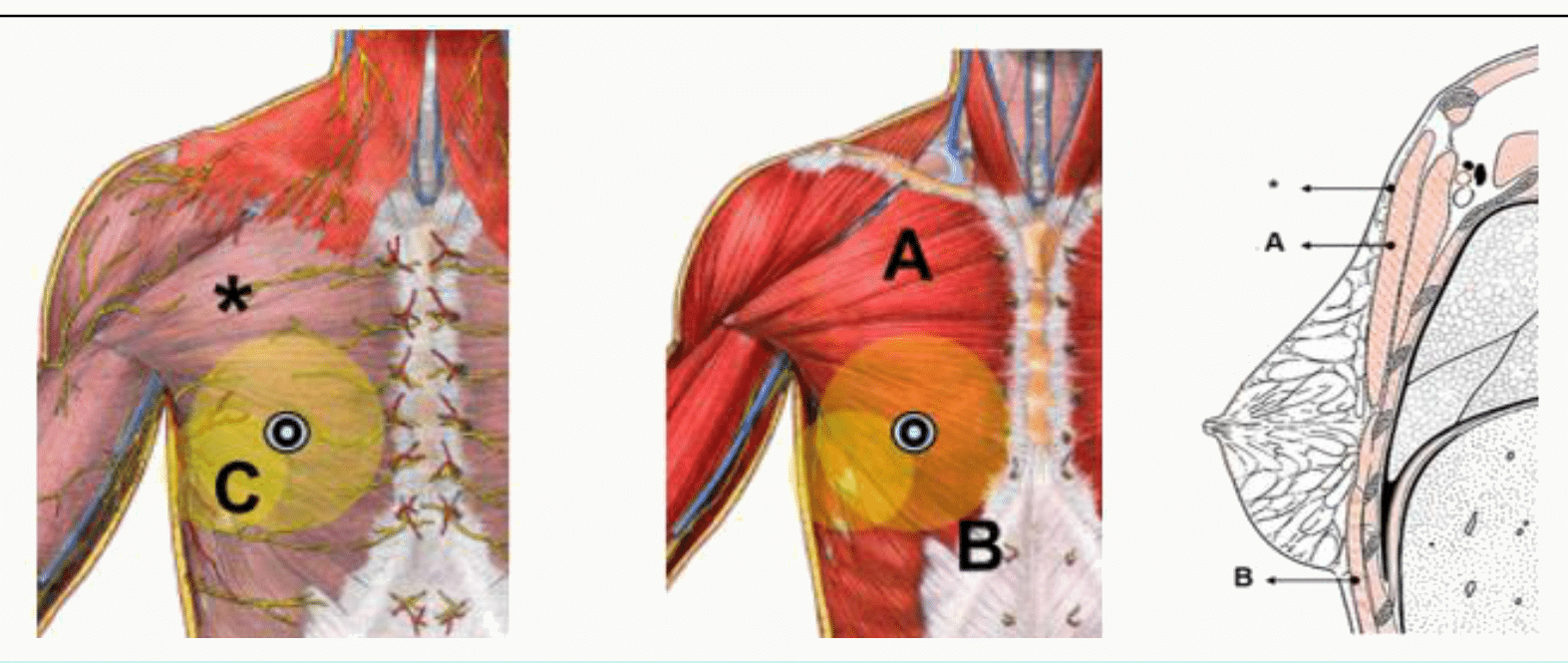 Rapports du sein avec le muscle grand pectoral et les muscles de la paroi thoracique