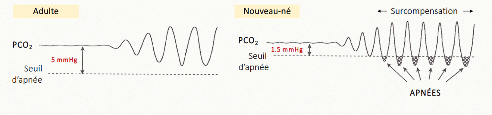 Schéma de la respiration périodique du nouveau-né montrant l'alternance hyperpnée-apnée avec les variations de PaCO2 autour du seuil d'apnée.