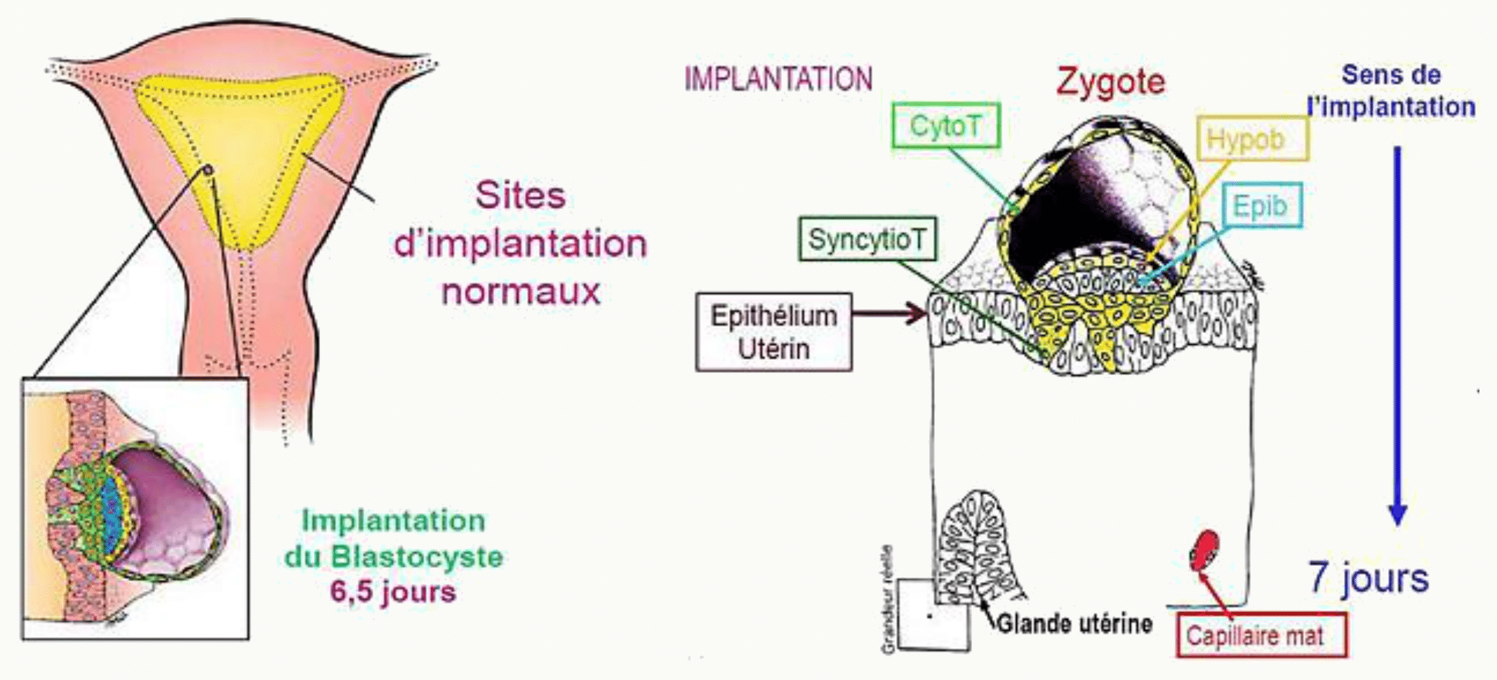 Sites d'implantation du placenta normaux et ectopiques