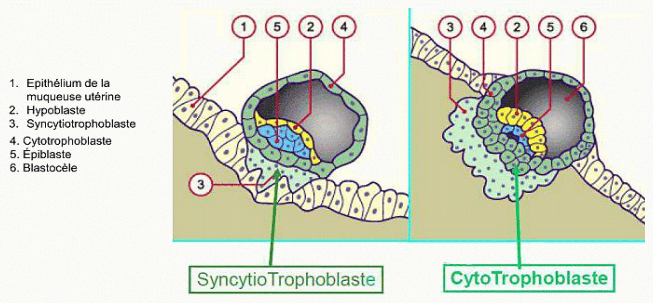 Blastocyste s'implantant dans l'endomètre : syncytiotrophoblaste invasif, cytotrophoblaste, épiblaste et hypoblaste