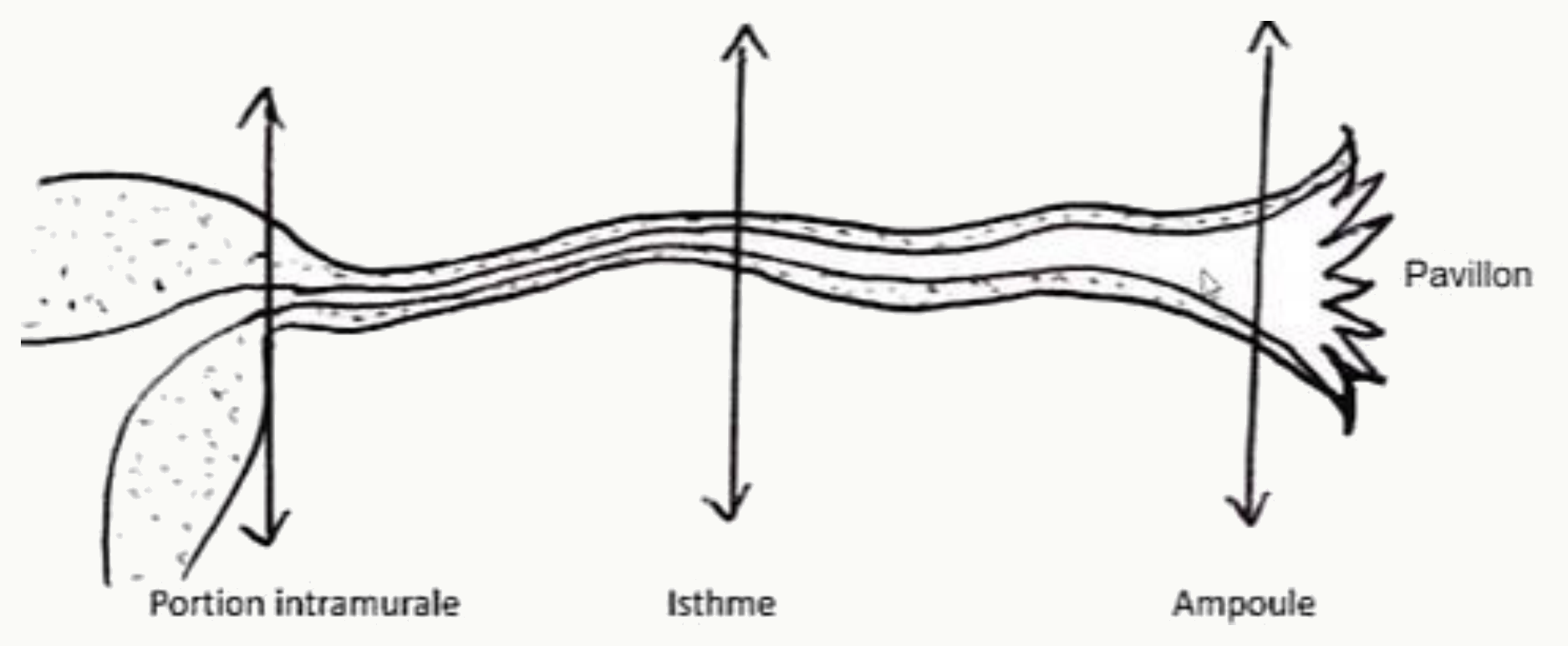 Trompe utérine : portions interstitielle, isthme, ampoule et pavillon
