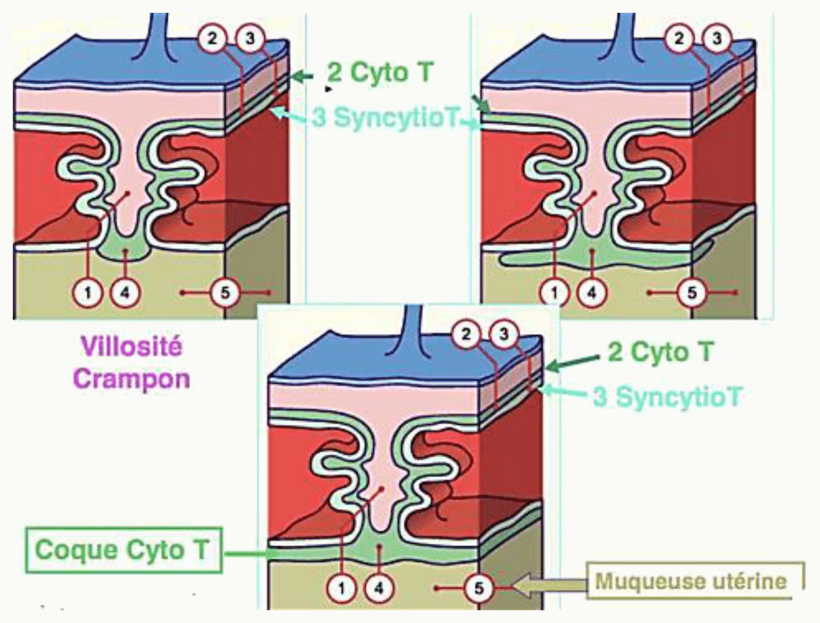 Villosité crampon et coque cytotrophoblastique