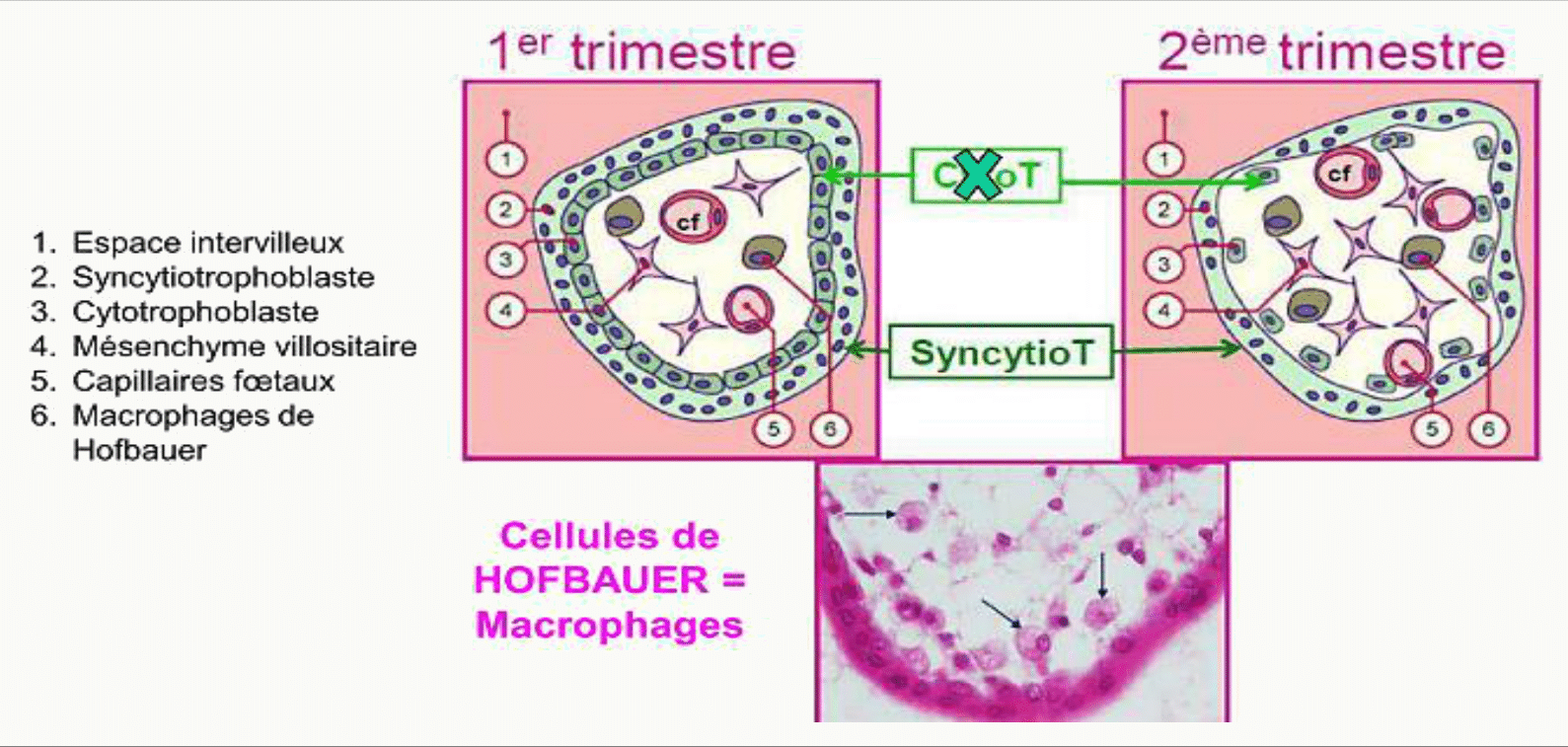 Villosités au premier et au deuxième trimestre