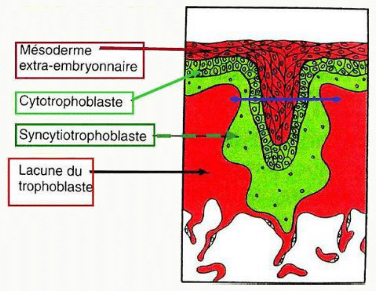 Villosité secondaire dont le centre est envahi par le mésoderme extra-embryonnaire, entouré du cytotrophoblaste puis du syncytiotrophoblaste